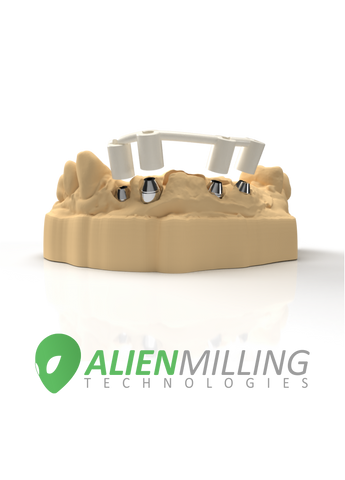 Verification Jig for Full Arch Hybrid