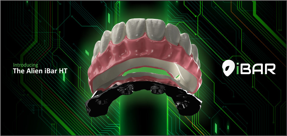 Alien iBar HT